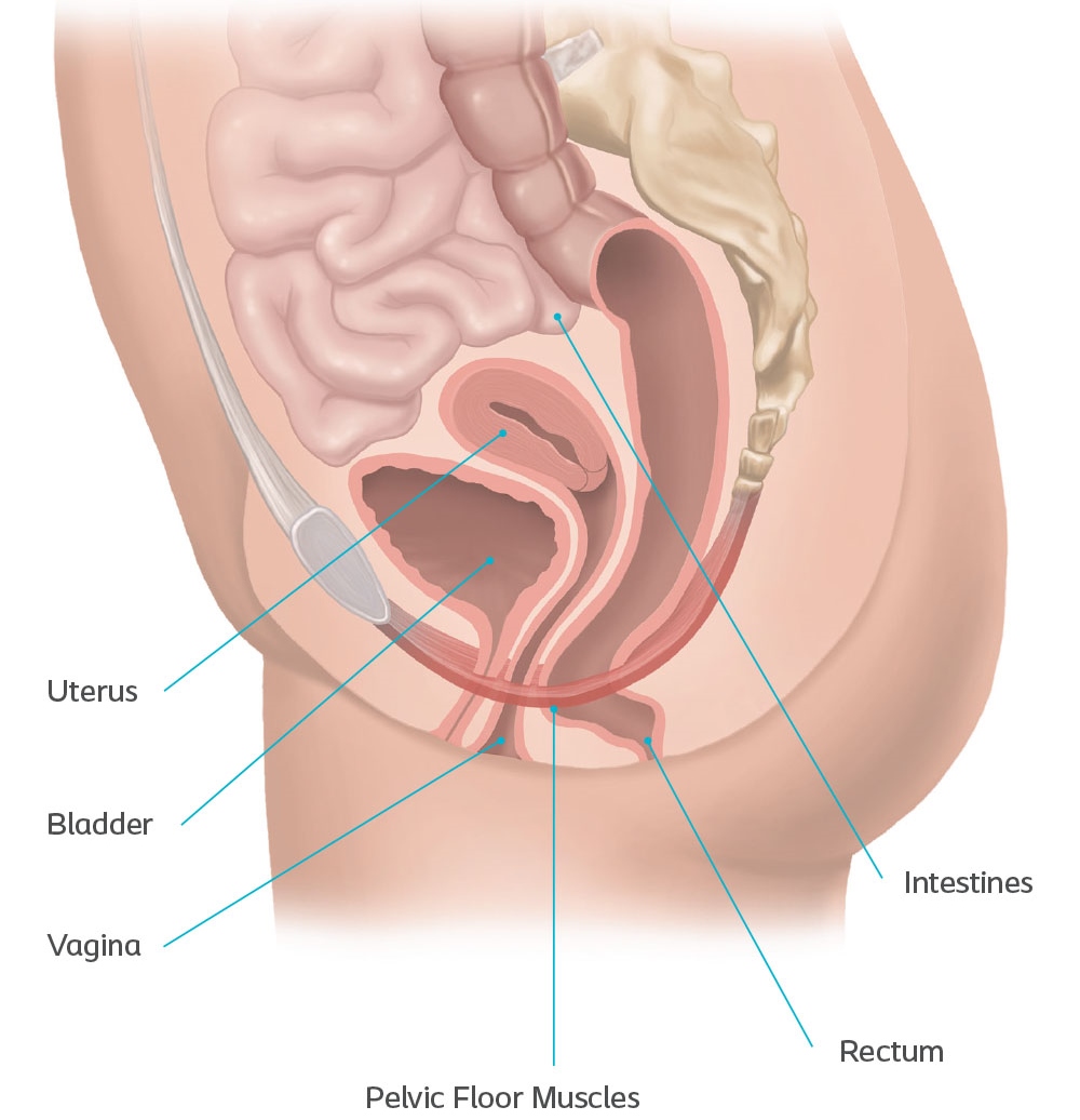 Diagram of the female pelvic floor, internal organs and causes of pelvic organ prolapse