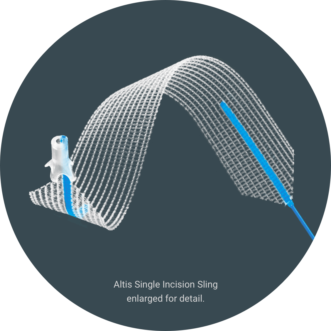 Atlis Single Incision Sling