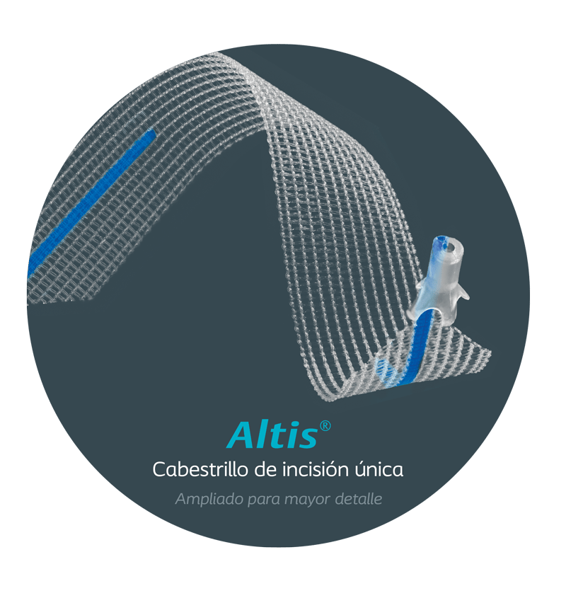 Alis SP